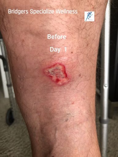 Before: open wound