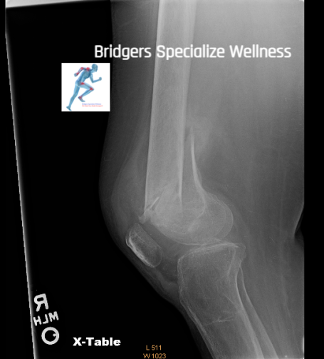 After: The bones are strong and looks good